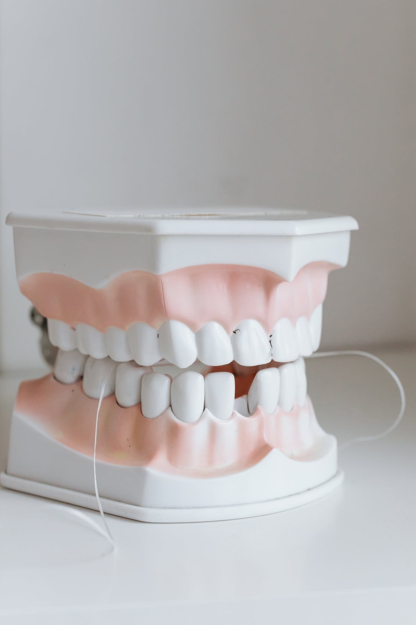 Teeth Extractions Close-Up Shot of a mouth model. Ivy Lane Dental offers teeth extractions in San Antonio, TX.