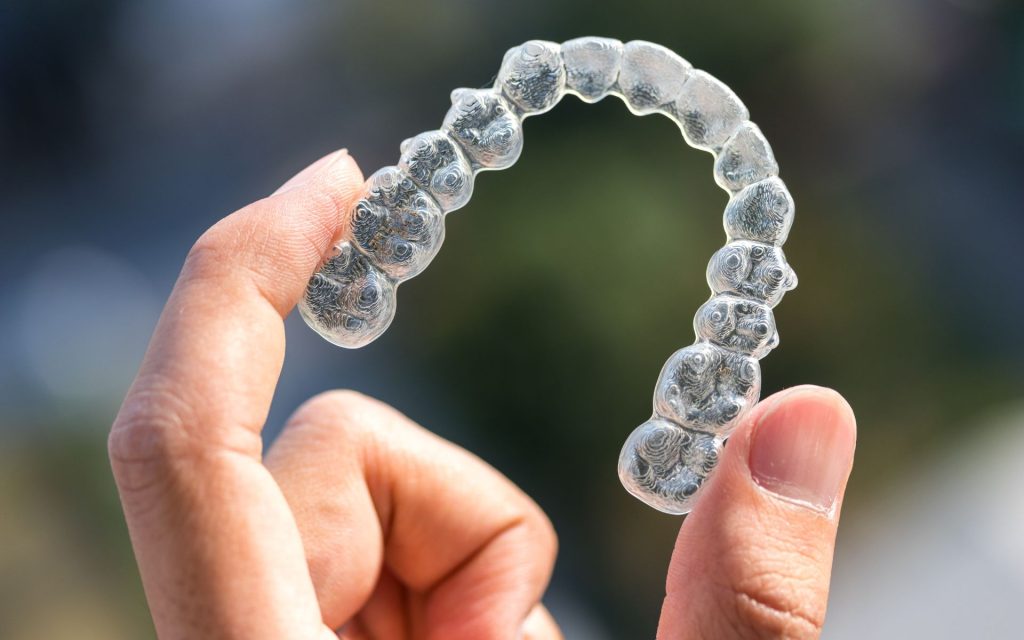Braces vs. Clear Aligners